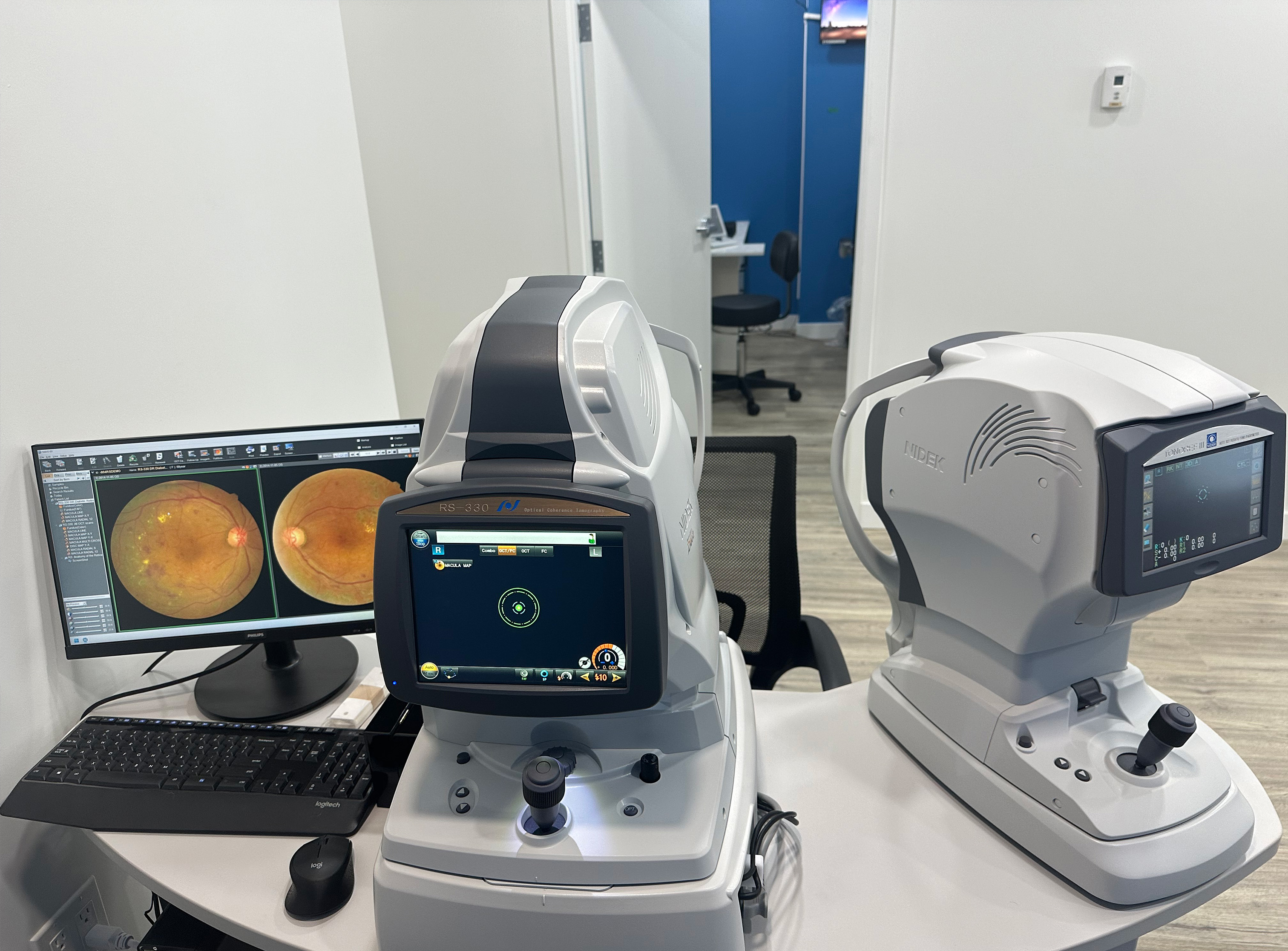 eye-exam-2